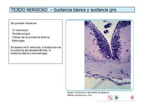 Nervioso.pdf