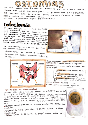 ostomias-resumen.pdf