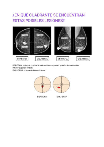 EN-QUE-CUADRANTE-SE-ENCUENTRAN-ESTAS-POSIBLES-LESIONES.pdf
