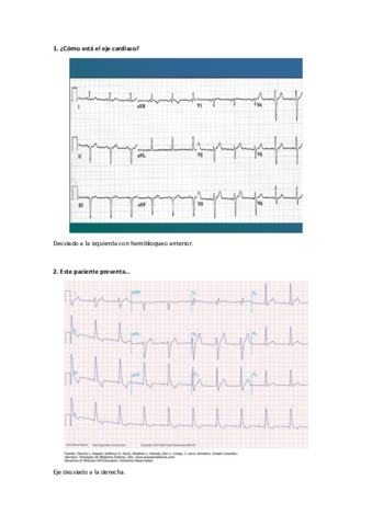 Preguntas-ECG.pdf