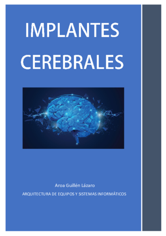 Implantes-cerebrales.pdf