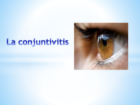 Manejo-y-diagnostico-de-la-Conjuntivitis.pdf