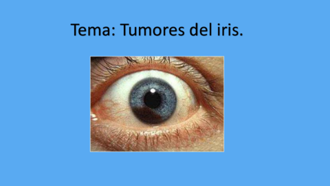 Presentacion-tumores-del-iris.pdf