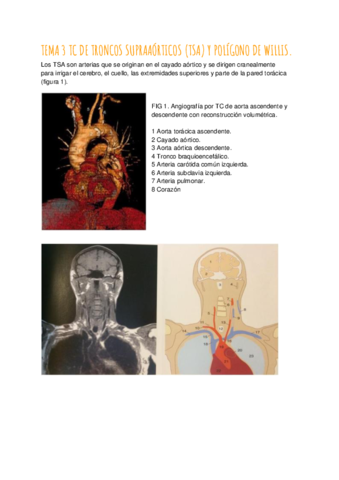 TEMA-3-TC-DE-TRONCOS-SUPRAAORTICOS-Y-POLIGONO-DE-WILLIS.pdf