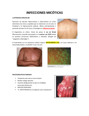 INFECCIONES-MICOTICAS.pdf
