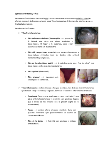 DERMATOFITOSIS-TINAS.pdf