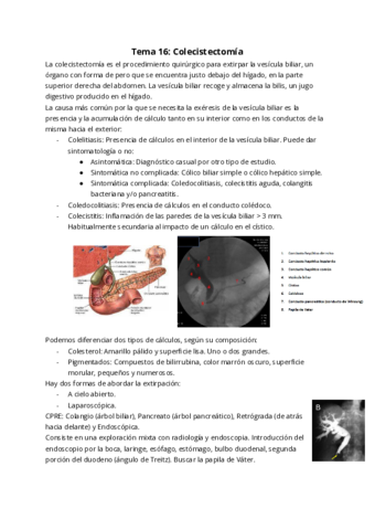 Tema-16-Colecistectomia.pdf