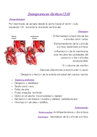 insuficiencia-Aortica-IA.pdf