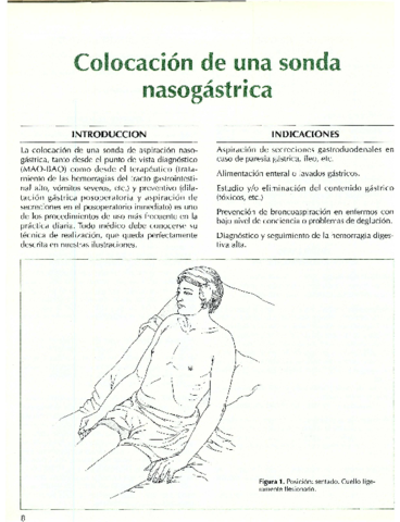 Sonda-nasogastrica.pdf