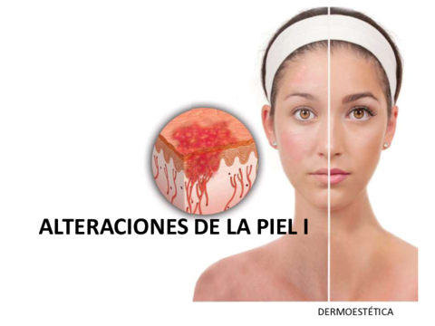 alteraciones-1.pdf