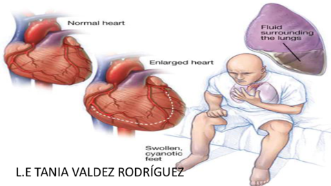INSUFICIENCIA-CARDIACA-CUIDADOS.pdf