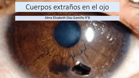 cuerpos-extranos-oculares.pdf