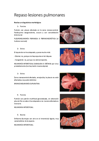 Repaso-lesiones-pulmonares.pdf