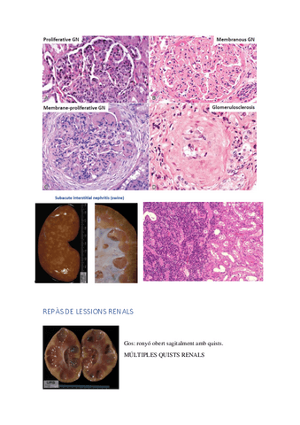 REPAS-DE-LESSIONS-RENALS.pdf