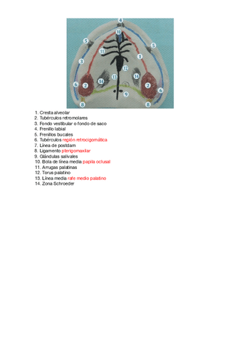 Correcion-de-arcada-superior.pdf