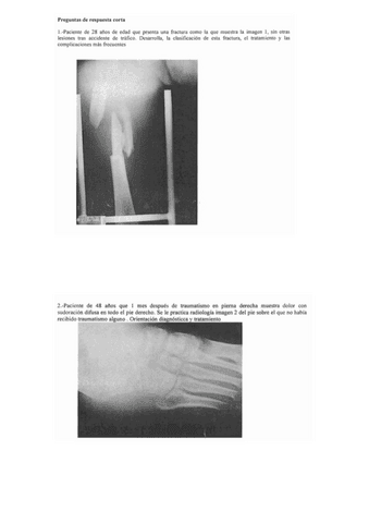 MIC1-1P-RECOPILATORI-CASOS.pdf