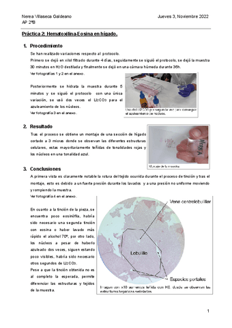 2-Hematoxilina-Eosina.pdf