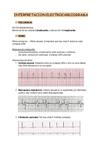 16.-INTERPRETACION-ECG.pdf
