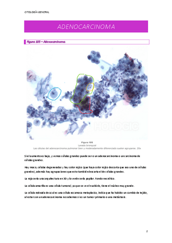 ADENOCARCINOMA.pdf