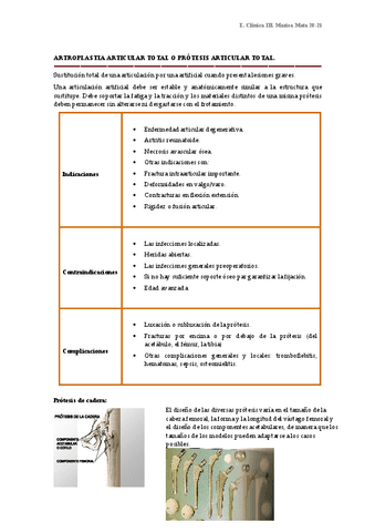 16.2.-ARTROPLASTIA-ARTICULAR-Y-CUIDADOS.pdf