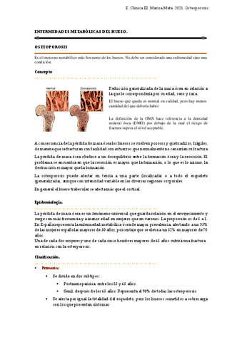 18.-OSTEOPOROSIS.pdf