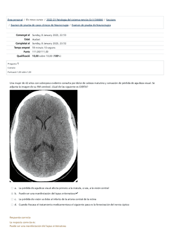 Examen-de-prueba-de-Neurocirugia-2022-2023.pdf