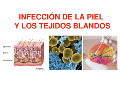 TEMA-7-infecciones-de-la-Piel.pdf