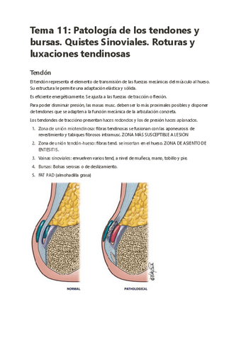 Tema-11-Patologia-de-los-tendones-y-bursas.-Quistes-Sinoviales.-Roturas-y-luxaciones-tendinosas.pdf