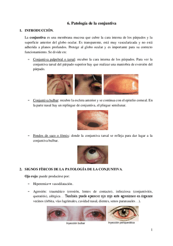 6.-Patologia-de-la-conjuntiva.pdf