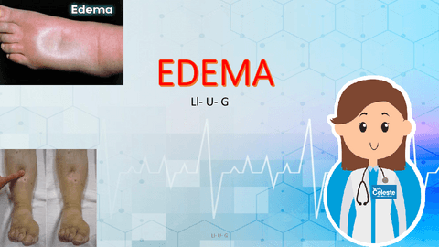 edema.pdf