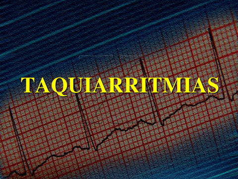 10.-Taquiarritmias.pdf