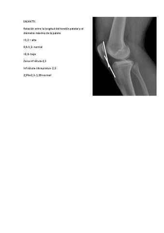 IMAGENES-PARA-GONIOMETRIA-DE-LA-RODILLA.pdf