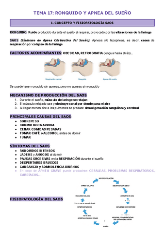 T17-RONQUIDO-Y-APNEA-DEL-SUENO.pdf