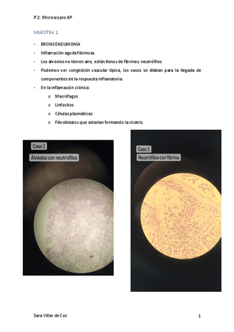 P.2.-Microscopio.pdf