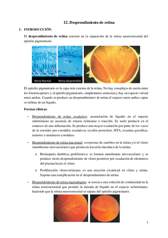 12.-Desprendimiento-de-retina.pdf