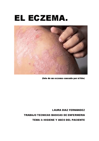 EL-ECZEMA.pdf