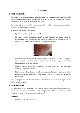 8.-Escleritis.pdf