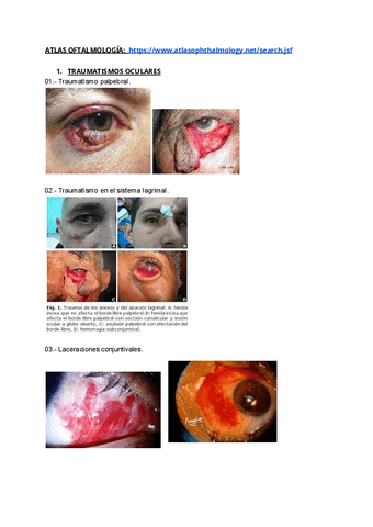 EXAMENES-IMAGENES-ECOE-OFTALMO.pdf