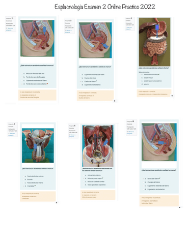 Esplacnologia-Examen-2-Online-Practico-2022.pdf