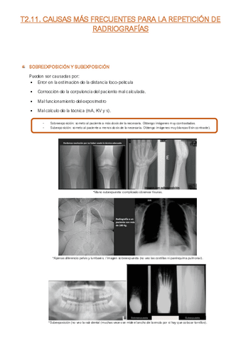 Resumen-T2.11-FFE-I.R.pdf