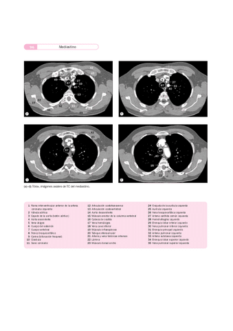 Imágenes radiológicas TAC RM.pdf