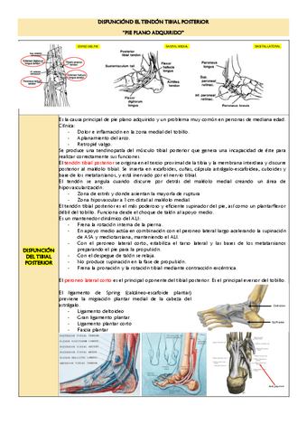 Disfuncion-del-tendon-tibial-posterior.pdf