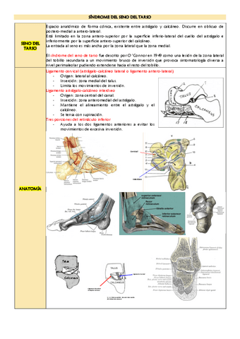 Sindrome-del-seno-del-tarso.pdf