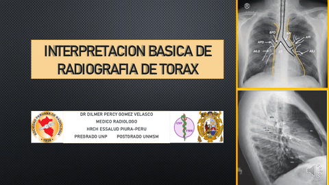 INTERPRETACION-BASICA-DE-RADIOGRAFIA-DE-TORAX.pdf