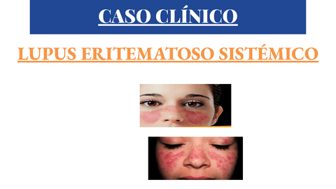 CASO-CLINICO-INMUNO.pdf
