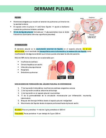 DERRAME PLEURAL.pdf