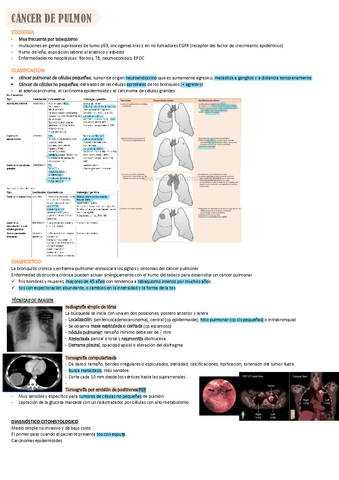 CANCER-DE-PULMON.pdf