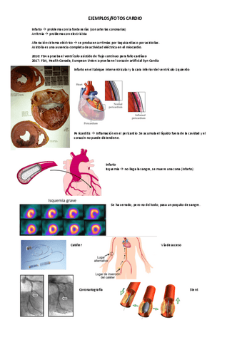 ejemplos-cardio.pdf