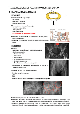 T2.-Fracturas-de-pelvis-y-luxaciones-de-cadera.pdf