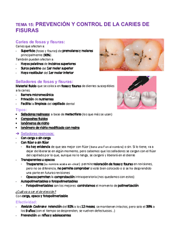 Tema-15-Prevencion-y-control-caries-fisuras.pdf